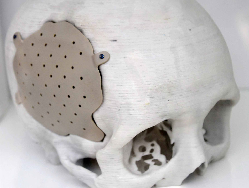 �@������ɫ�ĸ�ˎ��������Ŀ��������3D��ӡ���XĤ��